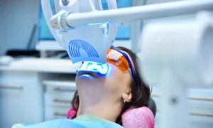 Benefits of teeth whitening